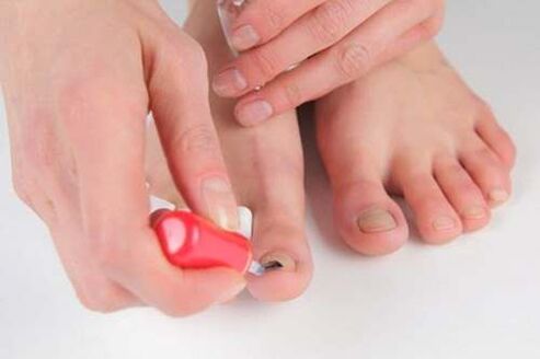 Nail varnish
