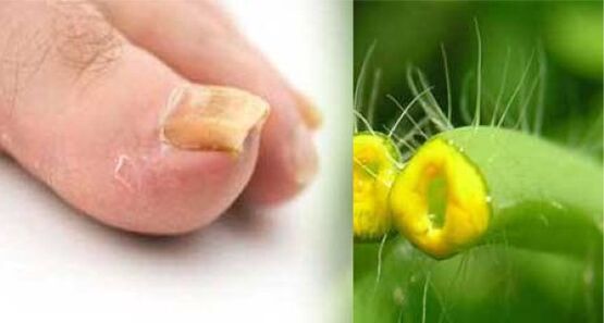 Chelidonium Herb for Toenail Fungus Treatment