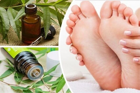 Tea tree oil eliminates onychomycosis