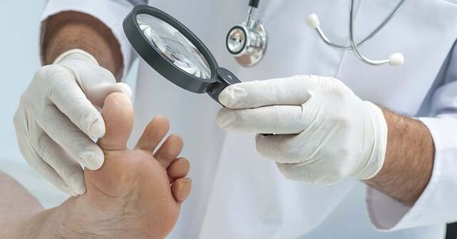 Doctors will prescribe medication to treat toenail fungus after the disease is diagnosed