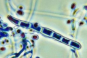 Nail fungal pathogens under the microscope