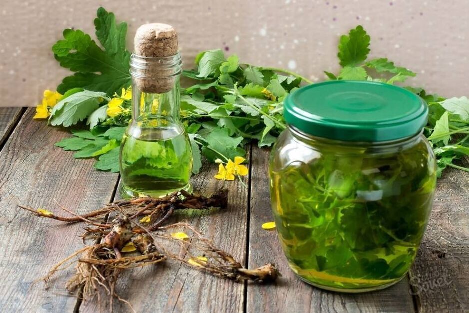 Celandine Tincture for Onychomycosis