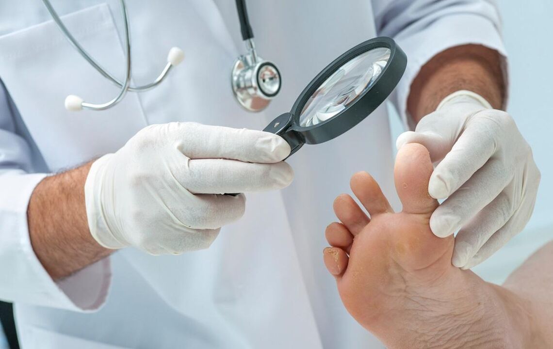 Doctor checks nails for fungus