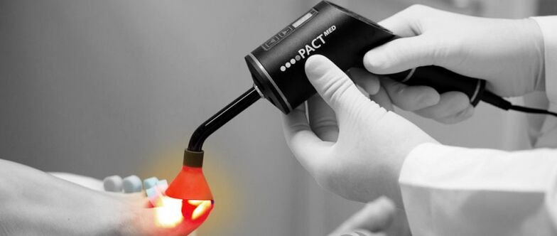 Laser treatment for toenail fungus
